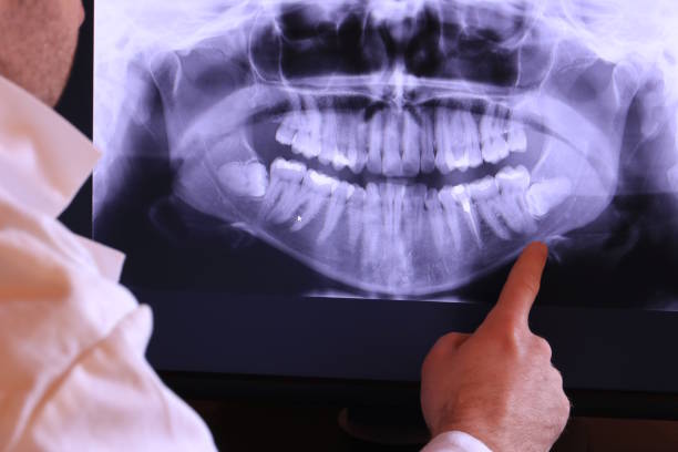 Best Same-Day Emergency Dental Services in New Berlinville, PA