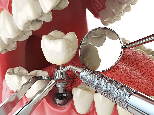 Best Cosmetic Emergency Dentistry in New Berlinville, PA