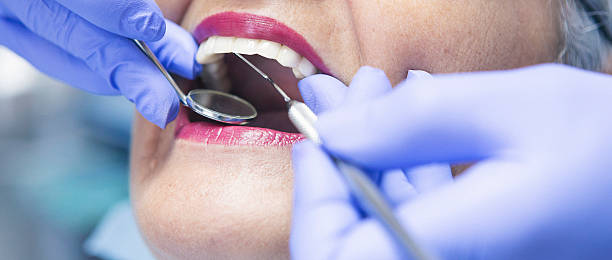 Best Emergency Dental Care for Broken or Chipped Teeth in New Berlinville, PA